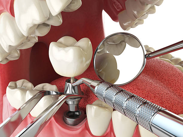 Best Weekend Emergency Dentist in Rosebud, TX
